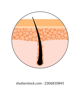Human hair anatomical poster. Hair follicle icon, skin layers structure diagram, epidermis and dermis, pores and cells medical poster. Dermatology clinic logo isolated flat vector illustration