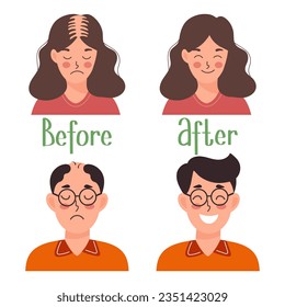 Trasplante de cabello humano. Mujeres y hombres antes y después del trasplante. Atención médica y medicina. Ilustración de dibujos animados, vector