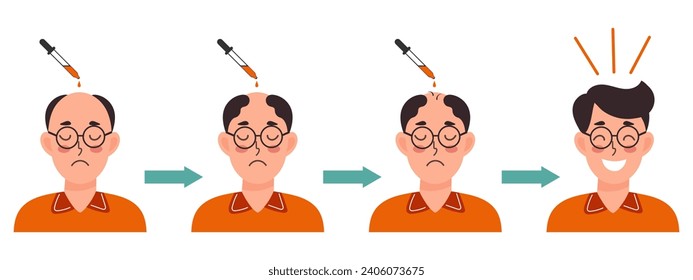 Trasplante de cabello humano y tratamiento de la calvicie. Hombre antes y después del tratamiento capilar. Salud y medicina. Ilustración de dibujos animados, vector