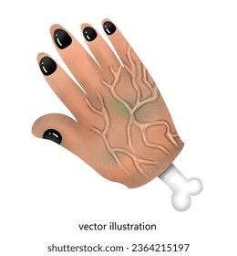 menschliche Hand mit schwarz-weißen Flecken. Vektorgrafik