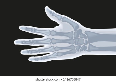 Human hand bones x ray anatomy vector illustration eps 10