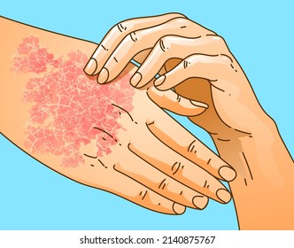 Human hands with skin disease. Itching, scabies. Healthcare illustration. Vector illustration. 