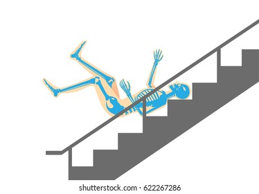 Human have physical injury from falling down stairs. Illustration about bone pain.