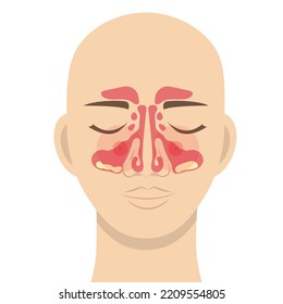 Human Head Schematic Image Maxillary Sinuses Stock Vector (Royalty Free ...