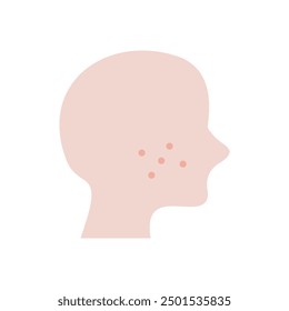 Menschliche Kopfseite mit Pickel Gesichtsstörung Symbol. Wange mit Akne im Gesicht. Gesundheit, Hygiene, Hautpflege, Allergie, Behandlung, Entzündungskonzepte. Flache Vektorgrafik, Entwurfsgrafik einzeln