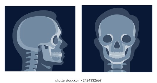 Human head x ray image skull front side view patient medical roentgen vector flat illustration. Skeleton person bone xray shot orthopedic laboratory diagnosis skeletal radiology surgery health care