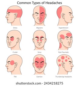 Human headache type structure diagram hand drawn schematic vector illustration. Medical science educational illustration