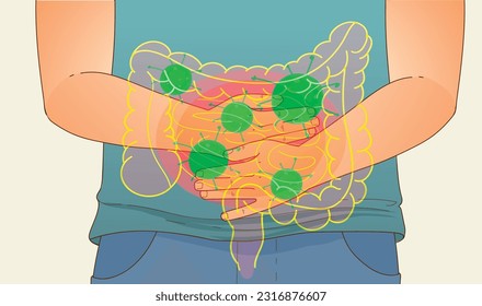 Humanos con problemas de salud. Colic. Dairea. Intoxicación alimentaria. Bacterias en el intestino. Indigestión. Problemas de salud. Ilustración médica. Ilustración vectorial.
