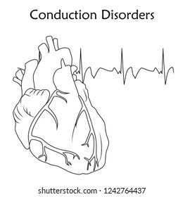 Human Heart. Conduction Disorders. Anatomy Flat Illustration. Outline Image, White Background. Heartbeat, Pulse.