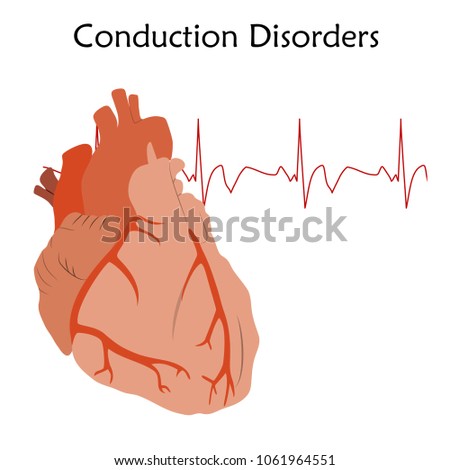 Human heart. Conduction Disorders. Anatomy flat illustration. Red image, white background. Heartbeat, pulse.