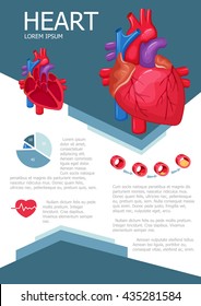 Human heart infographic poster with chart, diagram and icon. The process of atherosclerosis. Anatomy medical science. Vector brochure