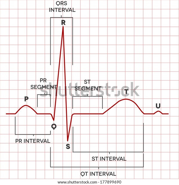 Human Heart Normal Sinus Rhythm Electrocardiogram Stock Vector (Royalty ...