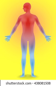 human heatstroke, thermic fever, thermoplegia, image illustration