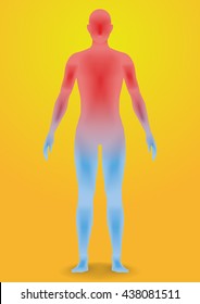 human heatstroke, thermic fever, thermoplegia, image illustration