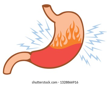 human internal stomach heartburn problems concept