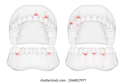 human jaw. 3d vector layout. medicine and health. pain teeth.