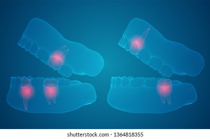 human jaw. 3d vector layout. medicine and health. pain teeth.