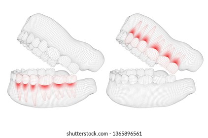 human jaw. 3d vector layout. medicine and health. pain teeth.