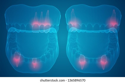 human jaw. 3d vector layout. medicine and health. pain teeth.