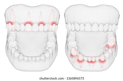 human jaw. 3d vector layout. medicine and health. pain teeth.