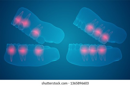 human jaw. 3d vector layout. medicine and health. pain teeth.