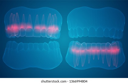 human jaw. 3d vector layout. medicine and health. pain teeth.