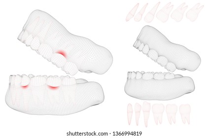 human jaw. 3d vector layout. medicine and health. pain teeth.