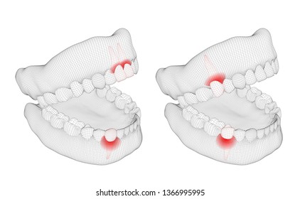 human jaw. 3d vector layout. medicine and health. pain teeth.