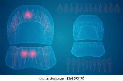 human jaw. 3d vector layout. medicine and health. pain teeth.