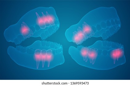 human jaw. 3d vector layout. medicine and health. pain teeth.