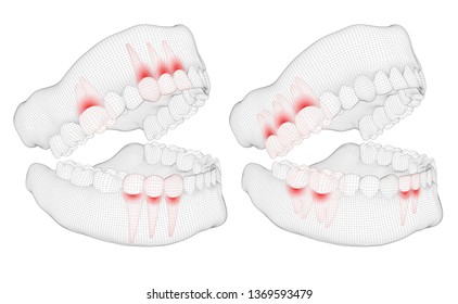 human jaw. 3d vector layout. medicine and health. pain teeth.