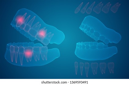 human jaw. 3d vector layout. medicine and health. pain teeth.