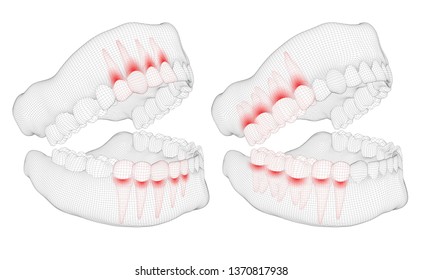 human jaw. 3d vector layout. medicine and health. pain teeth.