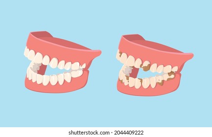 Human jaws isolated on white background. Clean and dirty teeth. Dental model of human jaws. Healthy oral hygiene. Trendy graphic for stomatology, dentist. Vector illustration