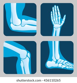 Human joints, knee and elbow joint, ankle joint and wrist. Medical orthopedic vector set. Anatomy human orthopedic illustration of leg and hand