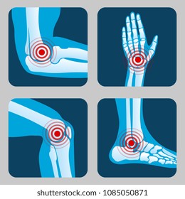 Human joints with pain rings. Arthritis and rheumatism infographic. Medical app vector buttons. Disease in joint bone, knee, leg and hand illustration