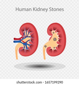 Piedras de riñones humanos, Riñon interior, Sistema de riñones, Forma Bean, Ilustración vectorial.