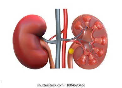 Human kidneys in section. Renal lithium. Vector graphics