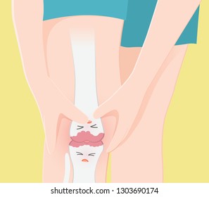 human knee bones have pain. patella injury 