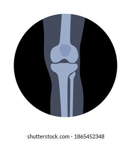 Human knee icon for clinic. Normal joints and bones anatomy in leg silhouette. Skeleton medical poster. Orthopedic or chiropractic treatment. Anatomical logo concept. Isolated flat vector illustration