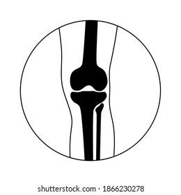Human knee icon for clinic. Normal joints and bones anatomy in leg silhouette. Skeleton medical poster. Orthopedic or chiropractic treatment. Anatomical logo concept. Isolated flat vector illustration
