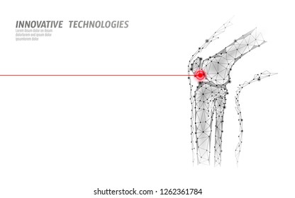 Human knee joint 3d model vector illustration. Low poly design future technology cure pain treatment. White background and red injury man body leg medicine template