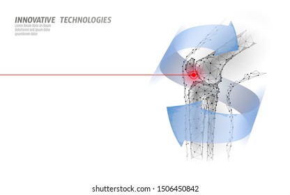 Human knee joint 3d model vector illustration. Low poly design future technology cure pain treatment. Blue background and red injury man body leg medicine template