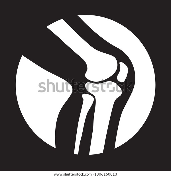 Human Knee Joint Side View Isolated Stock Vector (Royalty Free ...