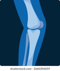 Radiografía del esqueleto de la rodilla humana