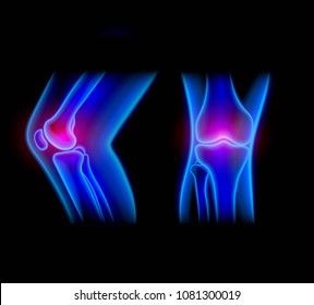 Human knee x-ray. 