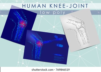 Human knee-joint low poly medicine science illustration set. Knee anatomical pain cure concept. Help keep health drug mechanism action on joint vector polygonal geometric point line