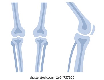Human knees bones and joints, examination and diagnosis. Healthcare and rheumatism analysis, physical care in hospital or clinics.