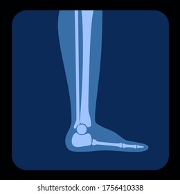 Human leg ankle bones anatomy on X Ray. Anatomical symbols. Vector flat concept illustration on reontgen. Isolated on blue background. Medical banner or poster for clinic.
