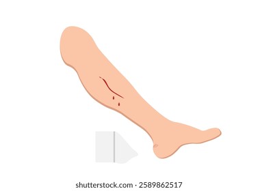 human leg with a bloody wound on a white background,